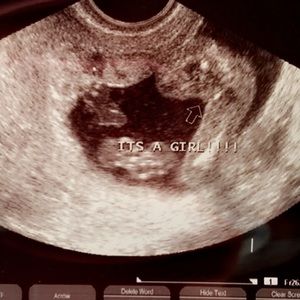 Meet your Posher, Dixie